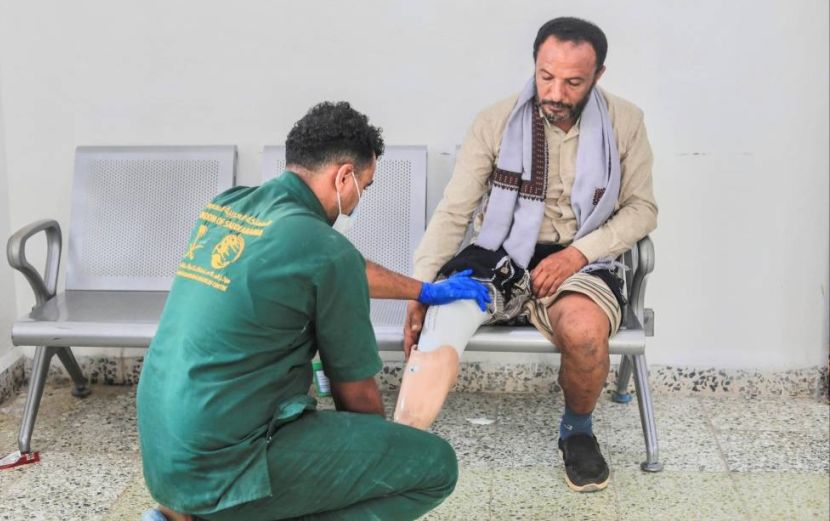 مركز الأطراف الصناعية بتعز يقدم 2395 خدمة لـ693 مستفيداً خلال شهر يوليو
